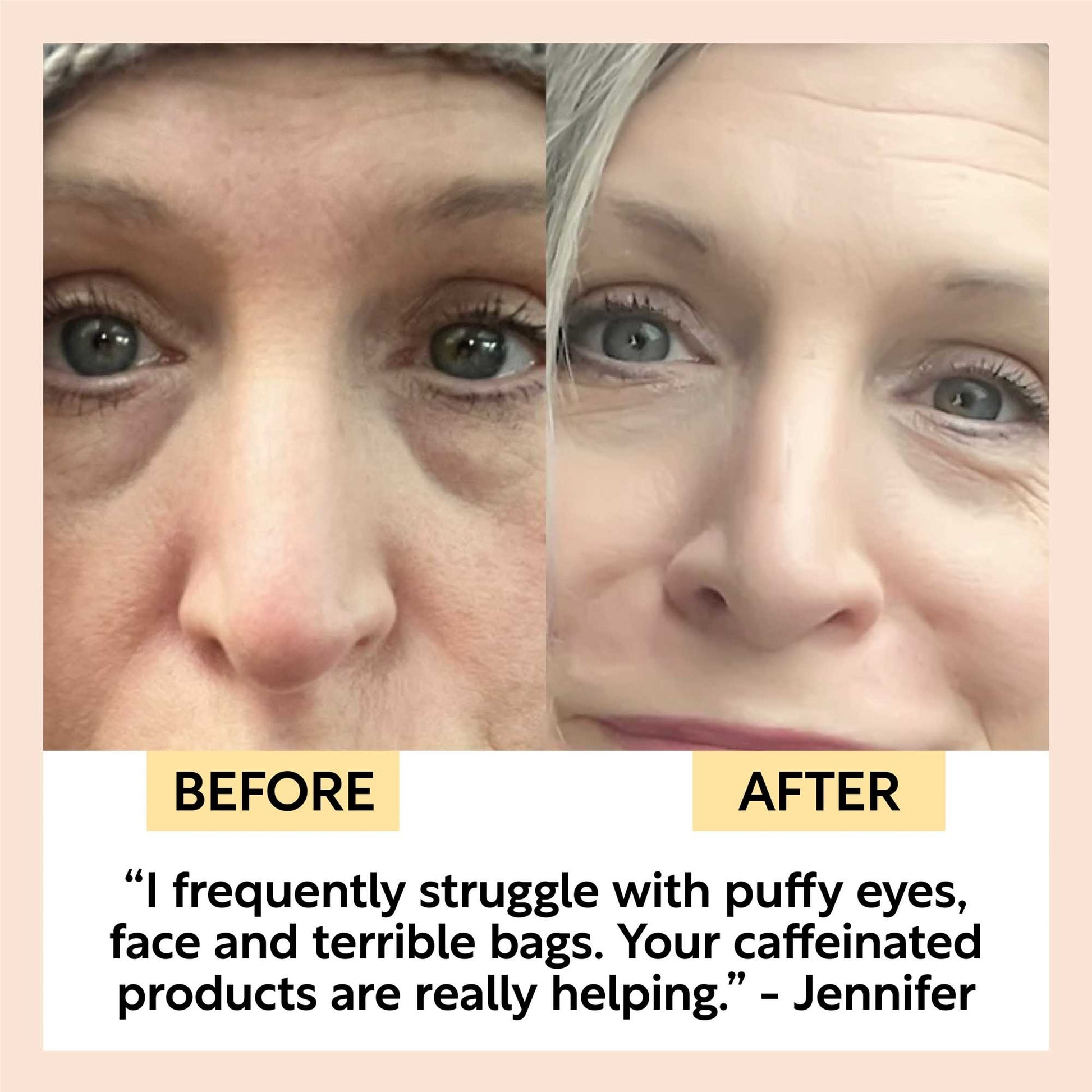 before and after from using the upcircle caffeinated duo products. Jennifer says 'i frequently struggle with puffy eye and terrible bags. your caffeinated products are really helping'
