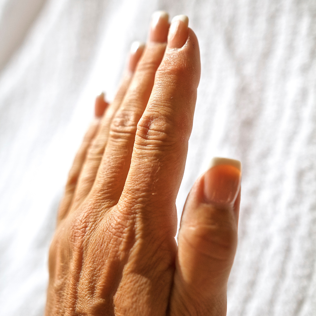 Dry Skin Conditions Talk | Friday 12th June 6pm | Social Self Care